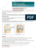 Arthritis of The Knee - OrthoInfo - AAOS