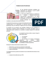 Tuberculosis Pulmonar