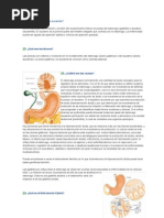 Duodenitis