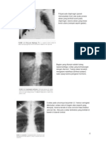 Gambar Kelainan Pada Radiologi