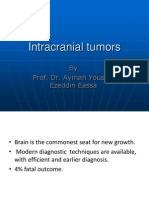 Intracranial Tumors: by Prof. Dr. Ayman Youssef Ezeddin Eassa