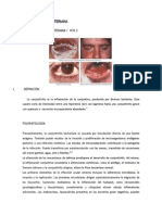 Conjuntivitis Bacteriana