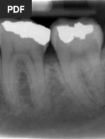 Anatomical Landmarks in Periapical Radiography