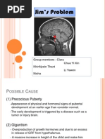 Precosious Puberty Case Study