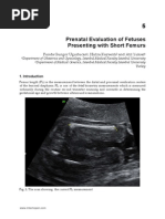 InTech-Prenatal Evaluation of Fetuses Presenting With Short Femurs