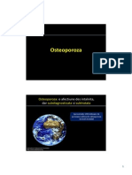 Osteoporoza