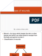 Types of Wounds