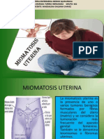 Miomatosis Uterina