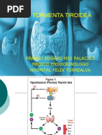  TORMENTA TIROIDEA, Dr. Franco Mio Palacios