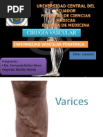 Varices