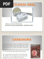 CARSINOMA