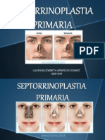 Septorrinoplastia