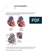 Insuficiencia Tricuspídea