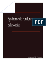 Condensations Alveolaires 2