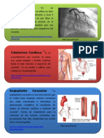 Aclaraciones Coronariografia y Angioplastia Coronaria