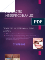 Desgastes Interproximales