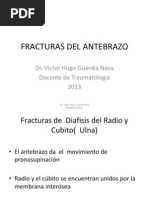 Fracturas de Diafisis Del Radio y Cubito (