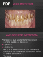 Amelogenesis Imperfecta