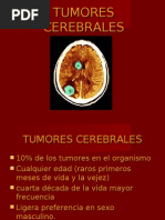 Tumores Cerebrales