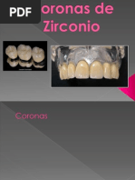 Coronas de Zirconio