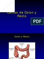 Cáncer de Colon