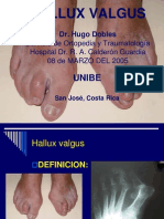 Hallux Valgus