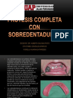 Prótesis Completa Con Sobredentaduras Corregida