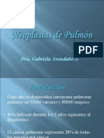 Neoplasia de Pulmon