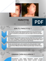 Parotitis