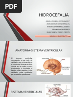 HIDROCEFALIA