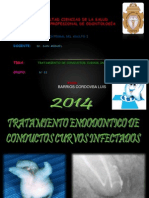 Tratamiento en Conductos Curvos Infectados