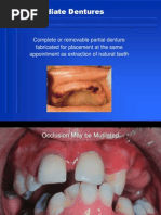 Immediate Denture