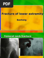 Fracture of Lower Extremity Fracture of Lower Extremity