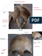 Sulcus For Superior Sagittal Sinus