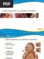 Labio Paladar Hendido