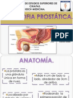 Hipertrofia Prostática