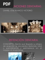 Retenciones Dentarias