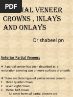 Partial Veneer Crowns, Inlays and Onlays: DR Shabeel PN