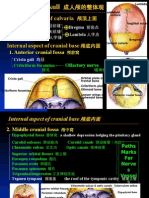 Superior Aspect of Calvaria: Suture Suture Suture