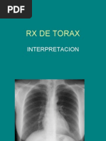 Interpretación de Radiografías Toracicas