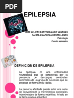 Epilepsia