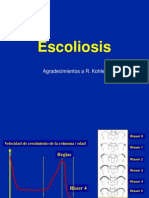 7 - Escoliosis