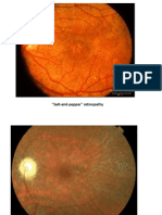 Ophthalmology Visuals