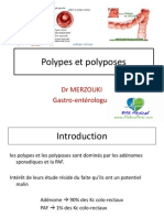 Polypes Et Polyposes