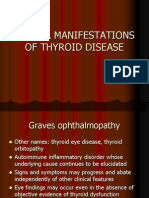 Ocular Manifestations of Thyroid Disease