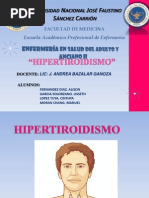 Hipertiroidismo Fisio