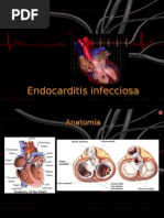 Endocarditis Infecciosa