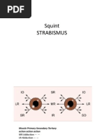 Strabismus