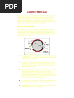 Cataract Extraction
