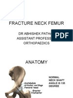 Fracture Neck Femur